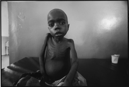 A Congolese child suffering from malnutrition waits to die in a clinic in North Kivu, DRC. Such images are perpetually used to provoke western media spectators to donate to corporate relief operations. Photo Keith Harmon Snow, 2005.